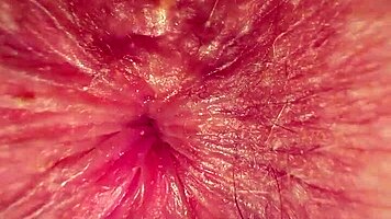 TEEN FACE SITS GASSY ASS ON TINY HEAD!