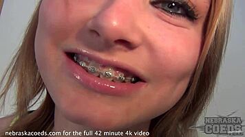 hey, check out this nervous teen 18+ in public, stripping panties to show her pink pussy and masturbating shyly outdoors with braces 😳👀