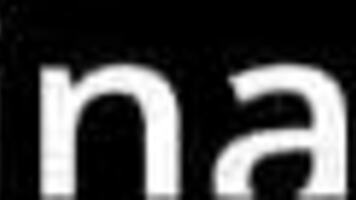 Tyler Lynn's Secret Abdominal Exam Exposed