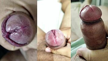 Phimosis Cock Explosive Jerk And Her Pussy Squirt!