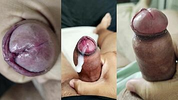 Phimosis Cock Explosive Jerk And Her Pussy Squirt!